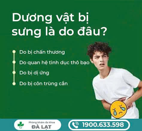 Hình ảnh minh họa